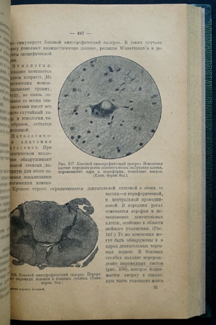 Учебник нервных болезней: анатомия, физиология, симптомология и лечение заболеваний нервной системы