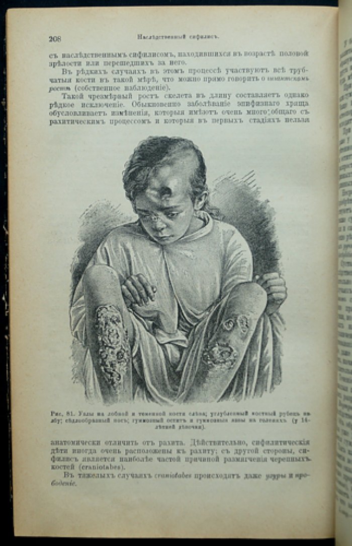 Учебник половых болезней. Венерические заболевания: этиология, симптомы, патология и лечение