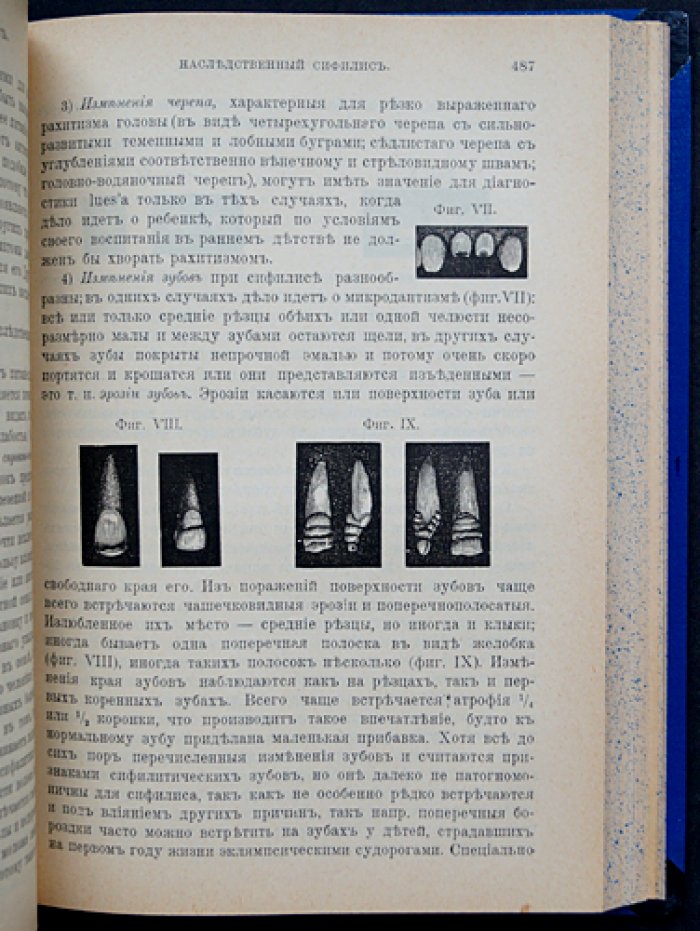 Семиотика и диагностика детских болезней: клинический разбор симптомов у детей (с терапевтическим указателем)