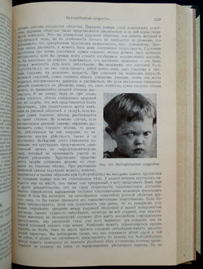 Руководство по глазным болезням (клинические лекции). Два тома