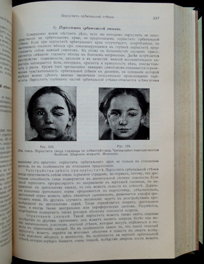 Руководство по глазным болезням (клинические лекции). Два тома