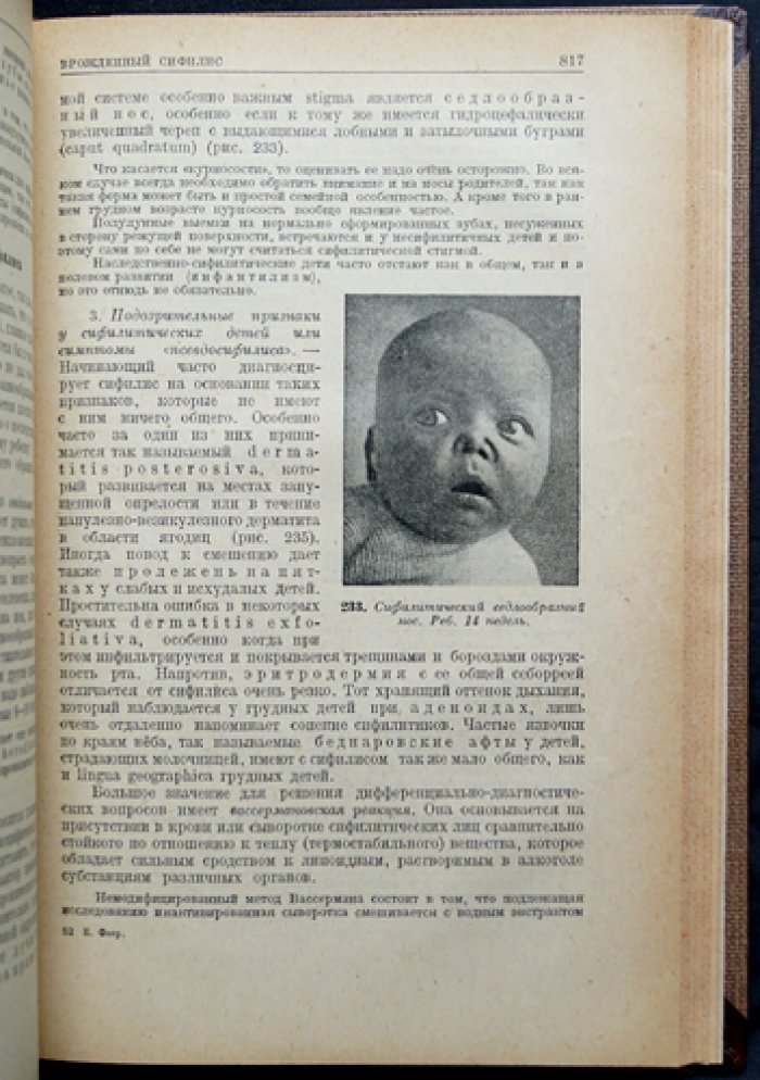 Феер. Руководство по детским болезням (педиатрия) — иллюстрированное издание, перевод с немецкого, редакция Колтыпина и Вейнберга, 1930