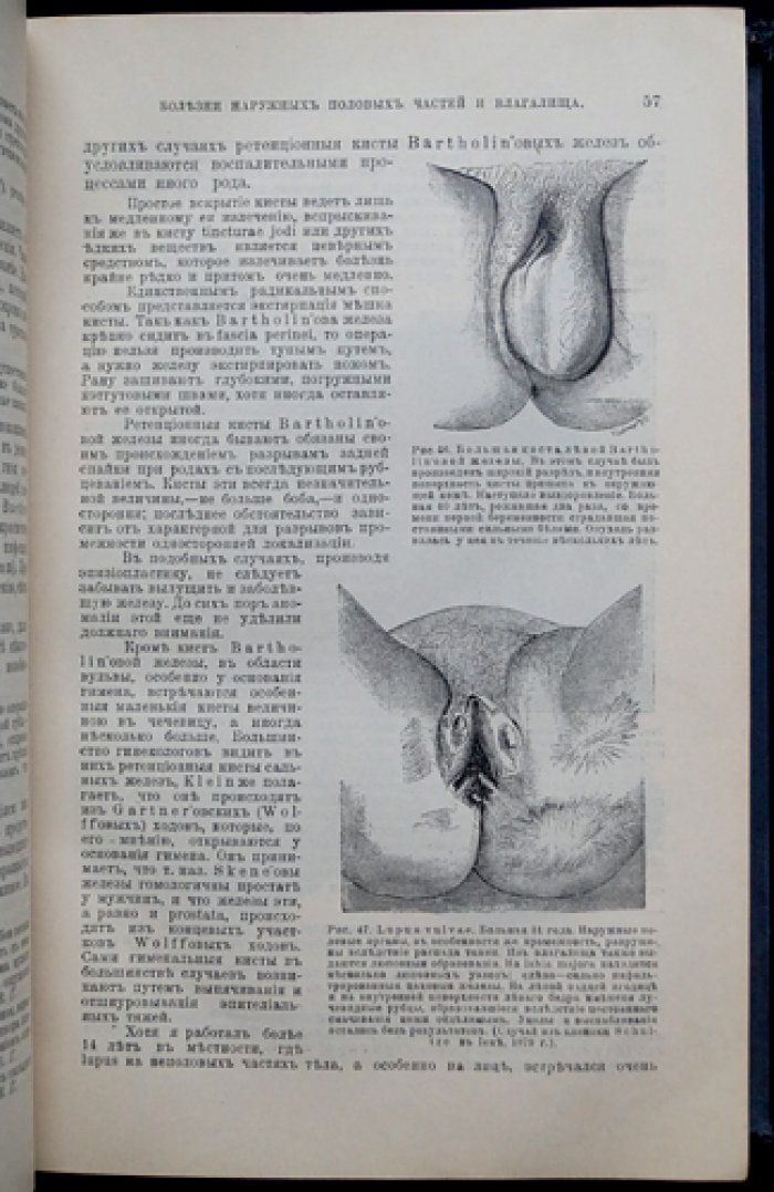 Краткий учебник гинекологии: учебное руководство с 260 рисунками (клиника, диагностика и оперативное лечение)