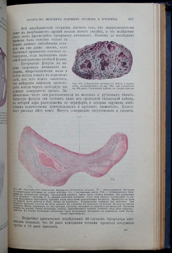 Краткий учебник гинекологии: учебное руководство с 260 рисунками (клиника, диагностика и оперативное лечение)