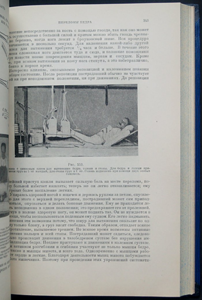 Техника лечения переломов костей (практическое руководство по травматологии)