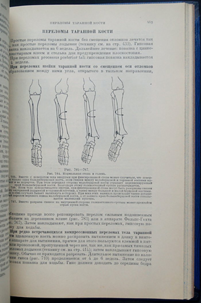 Техника лечения переломов костей (практическое руководство по травматологии)