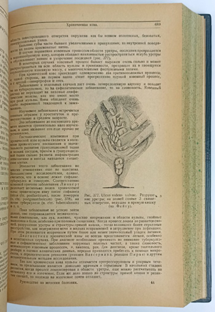 Руководство по женским болезням (энциклопедическое руководство по гинекологии)
