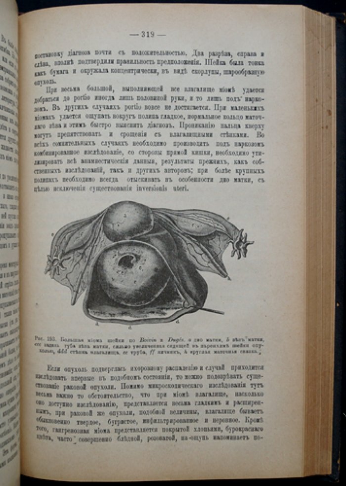 Женские болезни: руководство по гинекологии с диагностикой и лечением (с рисунками в тексте)