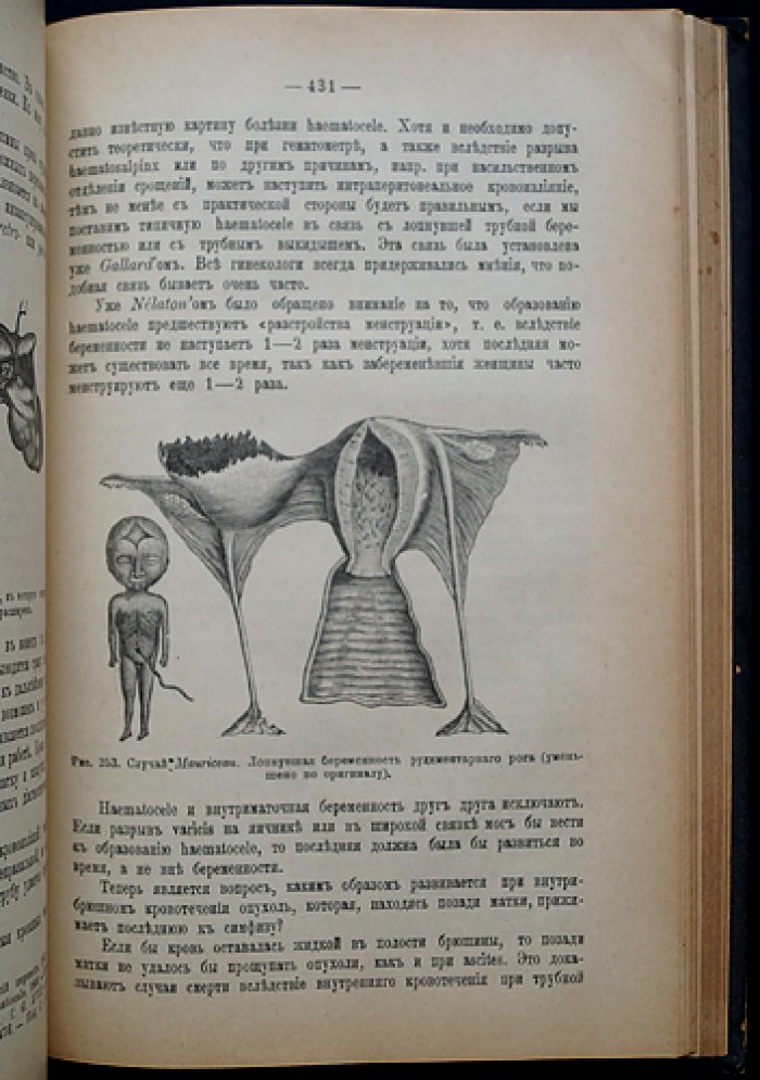 Женские болезни: руководство по гинекологии с диагностикой и лечением (с рисунками в тексте)