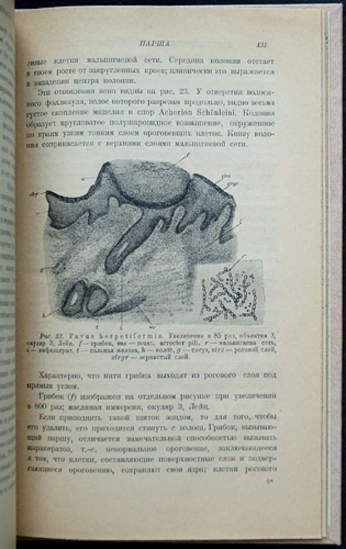 Макс Йозеф. Болезни волос: дерматологический справочник