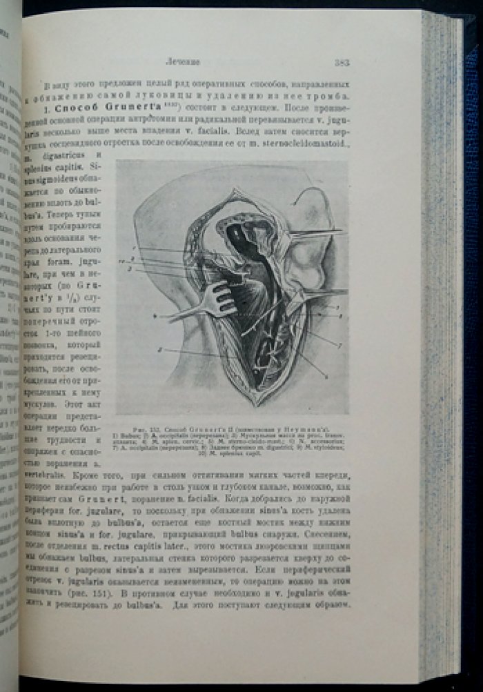 Хирургические болезни уха. Руководство по отохирургии (анатомия, клиника, оперативное лечение)