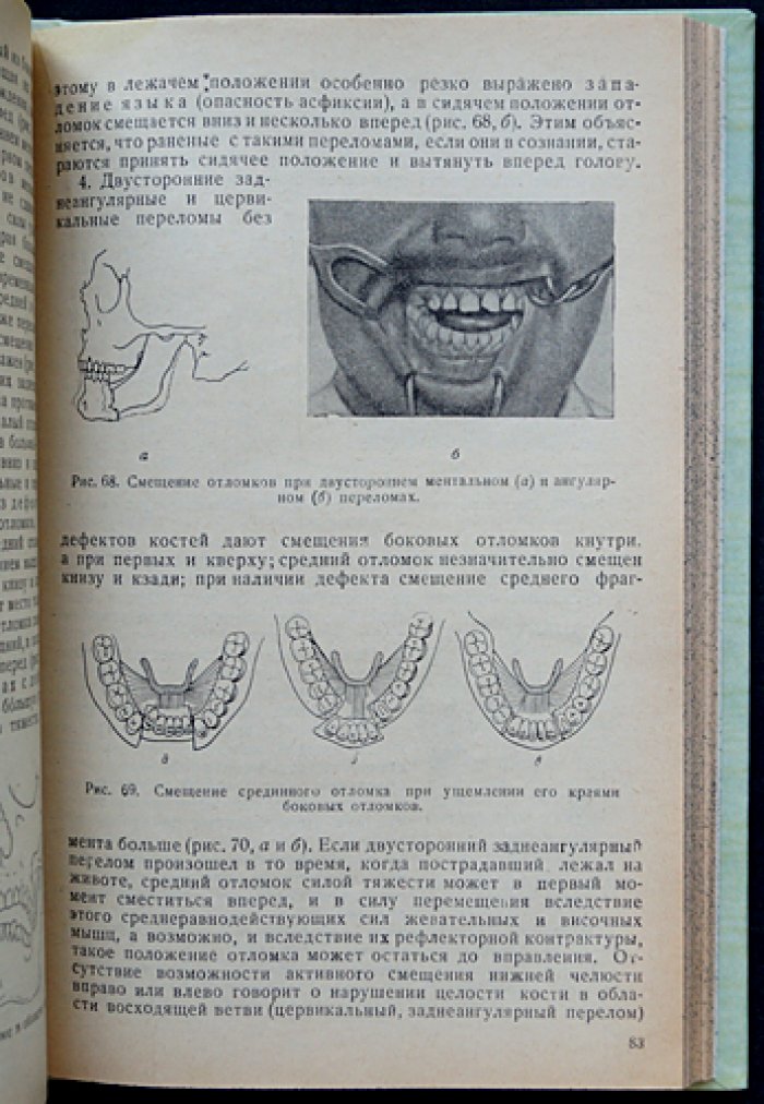 Военная челюстно-лицевая хирургия (с рисунками и атласом на вклейках)
