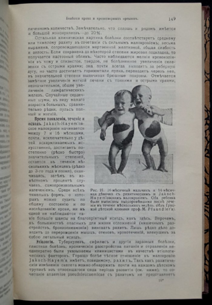 Феер Э. Проф. «Руководство по детским болезням» — авторитетный учебник педиатрии (с иллюстрациями и цветными таблицами)