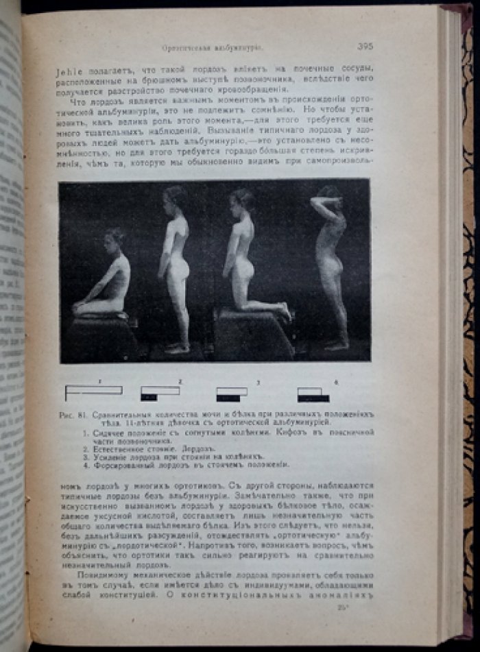 Феер Э. Проф. «Руководство по детским болезням» — авторитетный учебник педиатрии (с иллюстрациями и цветными таблицами)