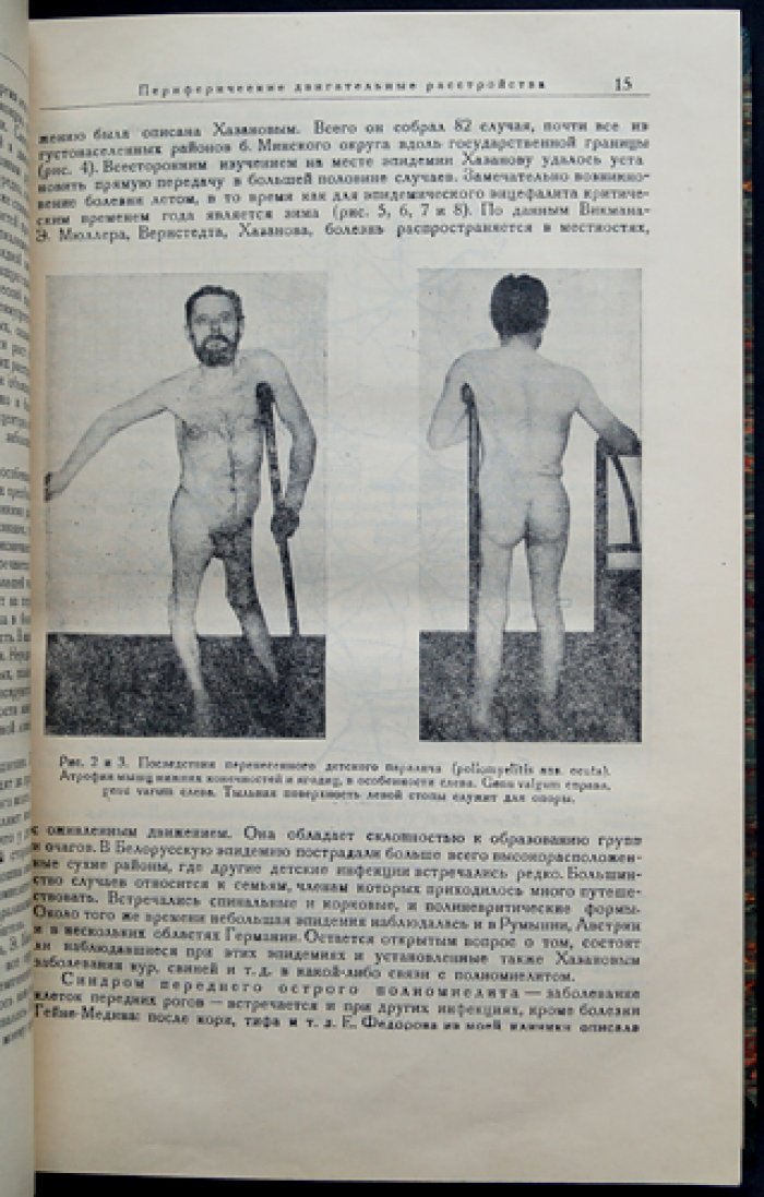 Невропатологические синдромы: клинические наблюдения и систематизация