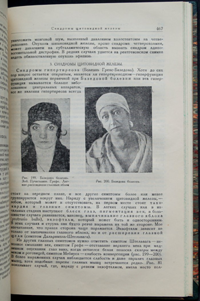 Невропатологические синдромы: клинические наблюдения и систематизация