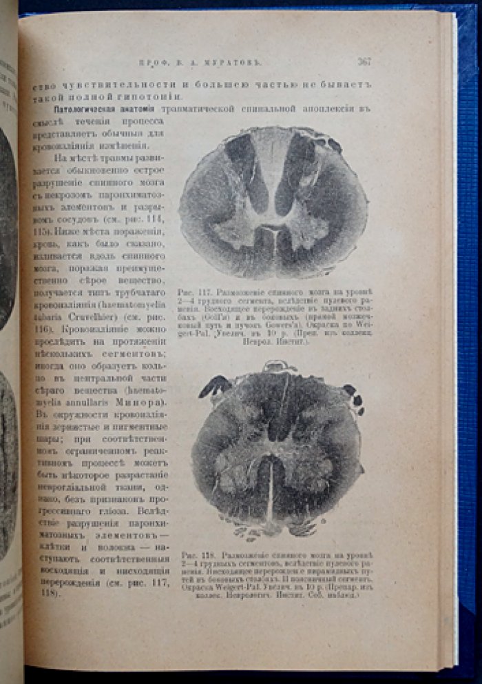 Муратов В. А. Руководство к изучению болезней нервной системы (выпуск I): общая симптоматология, диагностика, периферические нервы и спинной мозг