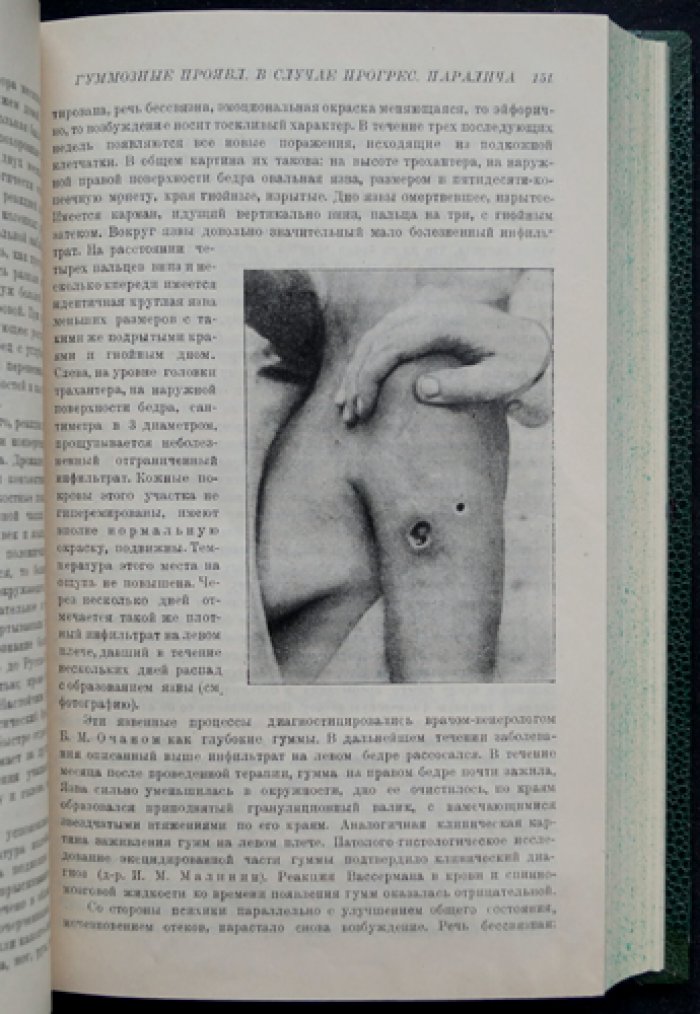 Журнал невропатологии и психиатрии им. С.С. Корсакова. Годовой комплект за 1927 год (№ 1–6)