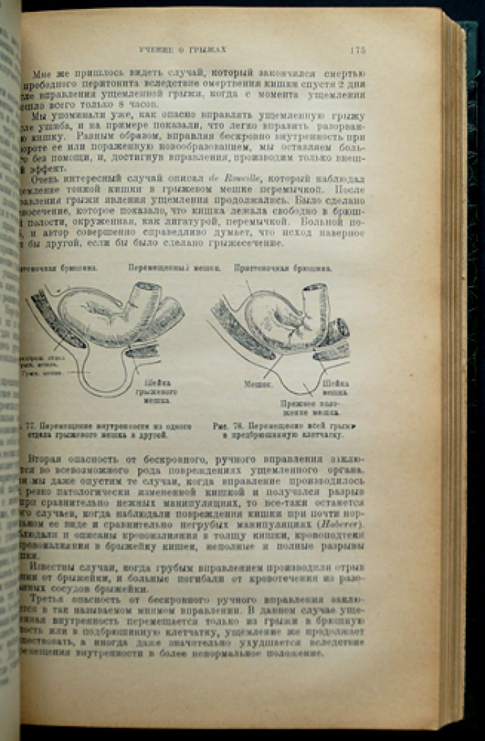 Учение о грыжах. Общая и специальная герниология