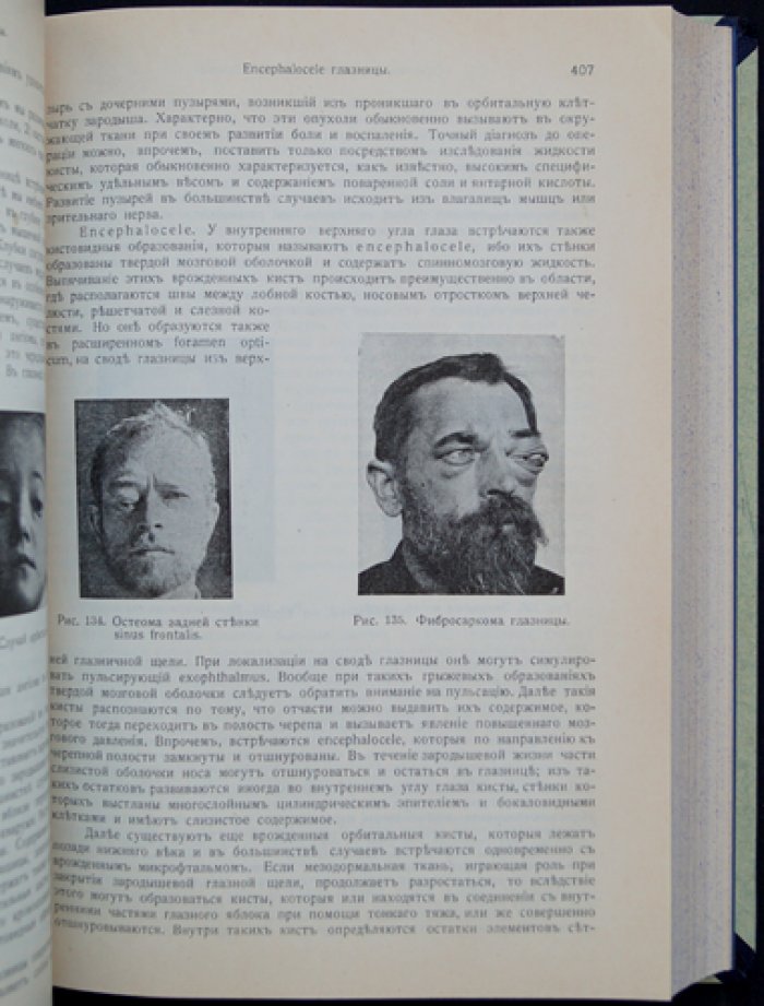 Руководство по глазным болезням в форме клинических лекций (в 2 томах)