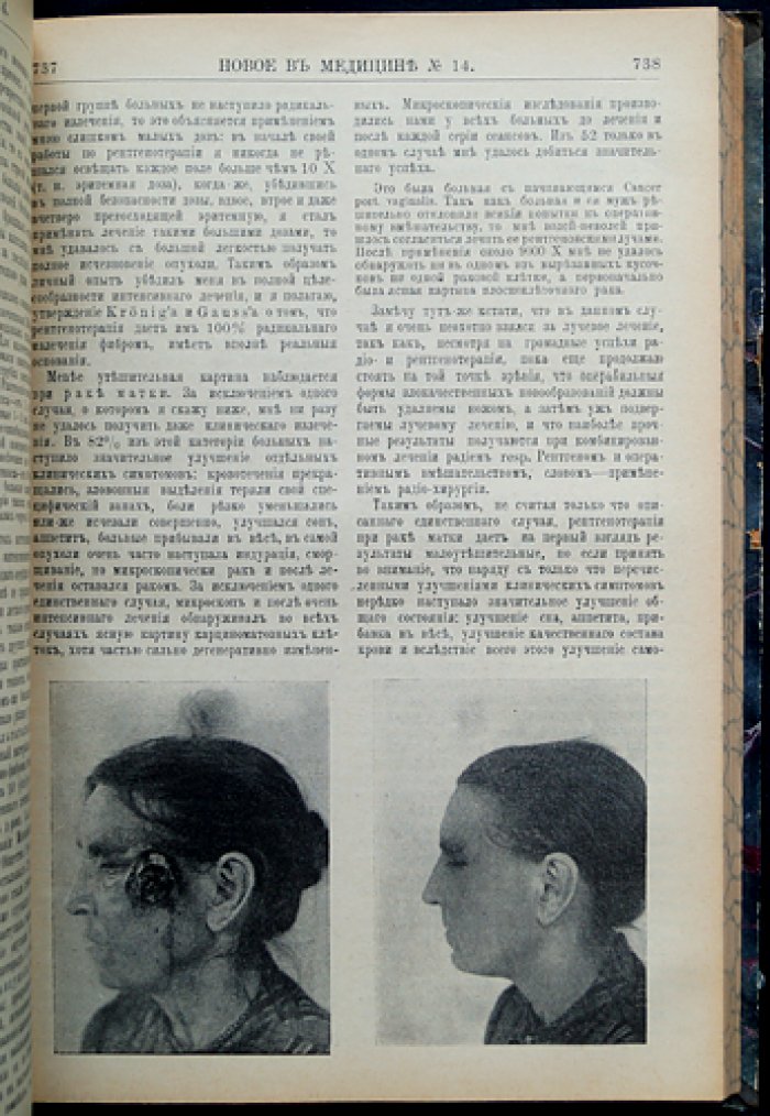Новое в медицине. Журнал по вопросам практической медицины (полный комплект за 1914 год)