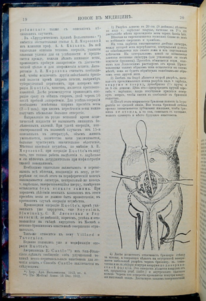 Новое в медицине. Журнал по вопросам практической медицины (полный комплект за 1913 год)