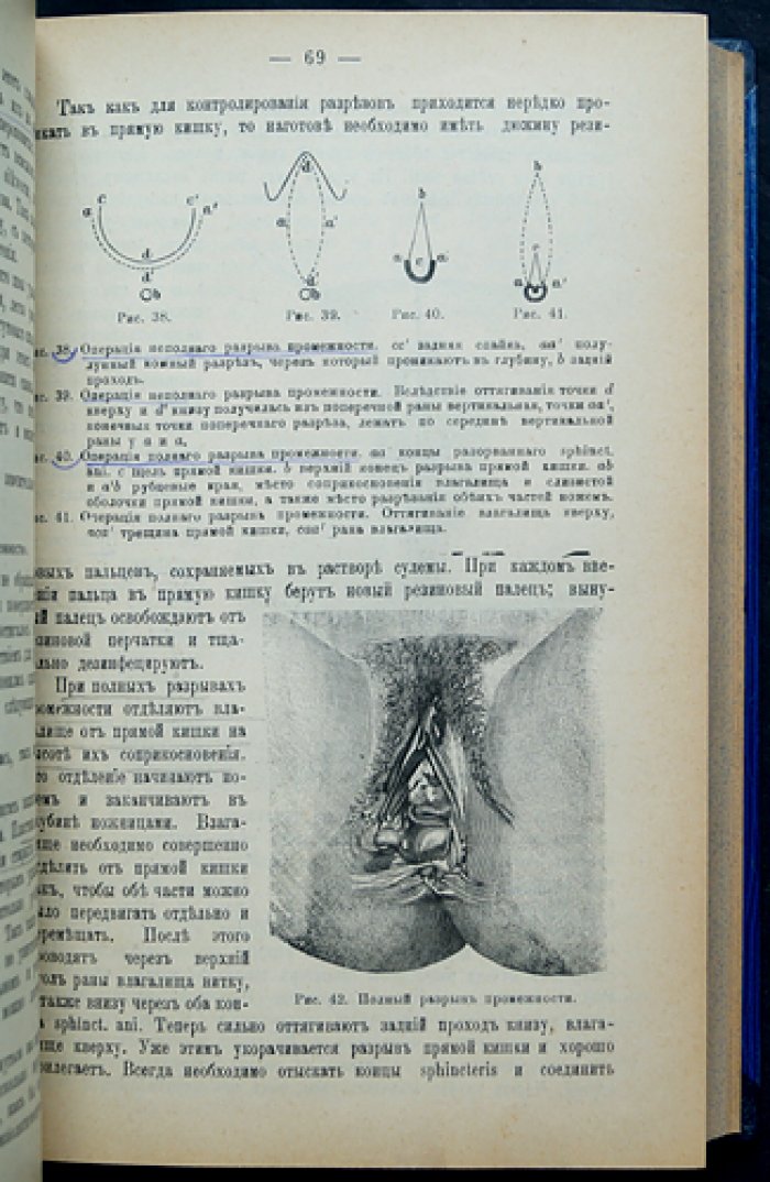 Женские болезни: руководство по диагностике и лечению (с 278 рисунками)