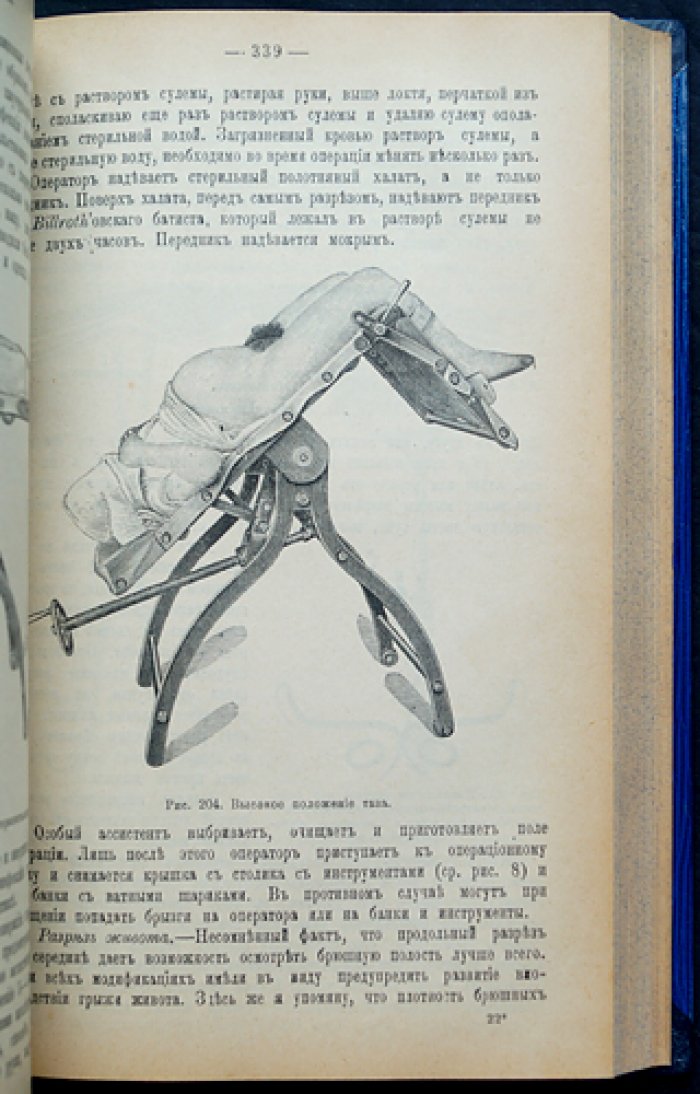 Женские болезни: руководство по диагностике и лечению (с 278 рисунками)