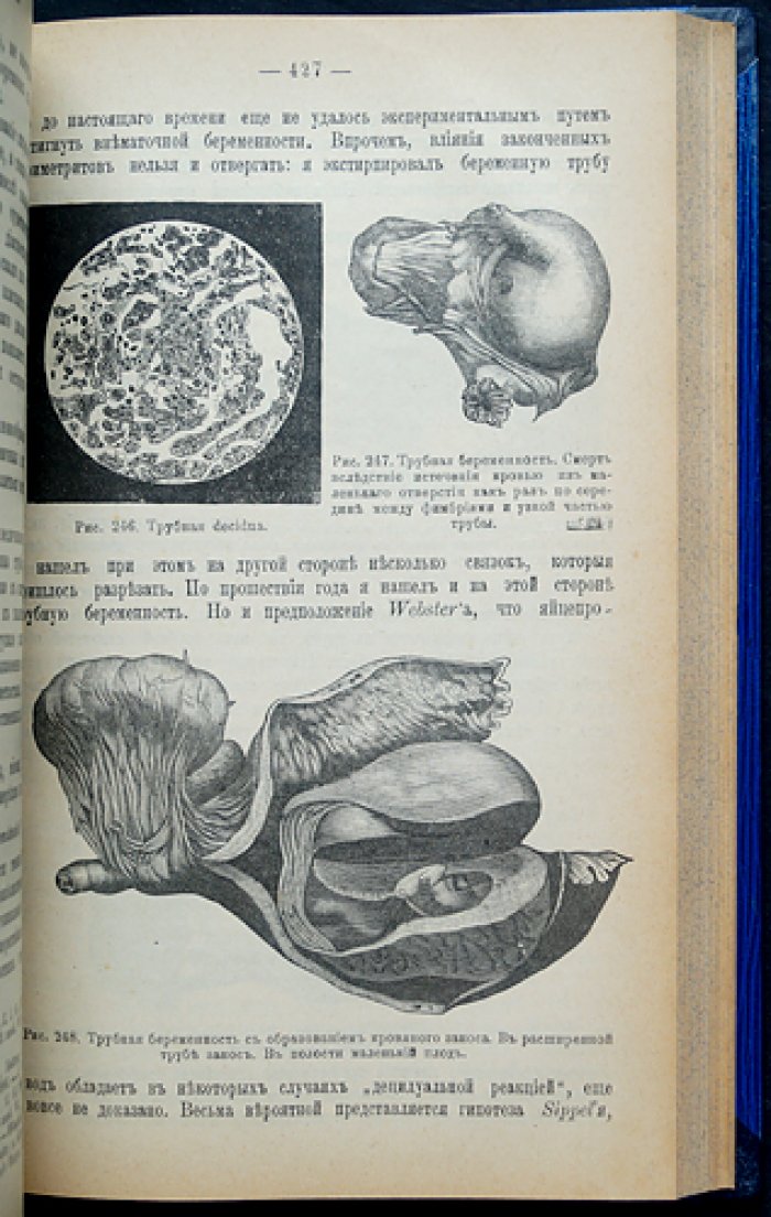Женские болезни: руководство по диагностике и лечению (с 278 рисунками)