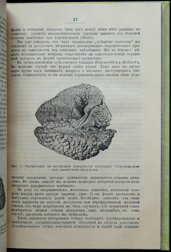 Клинические лекции по нервным болезням детского возраста (1898)
