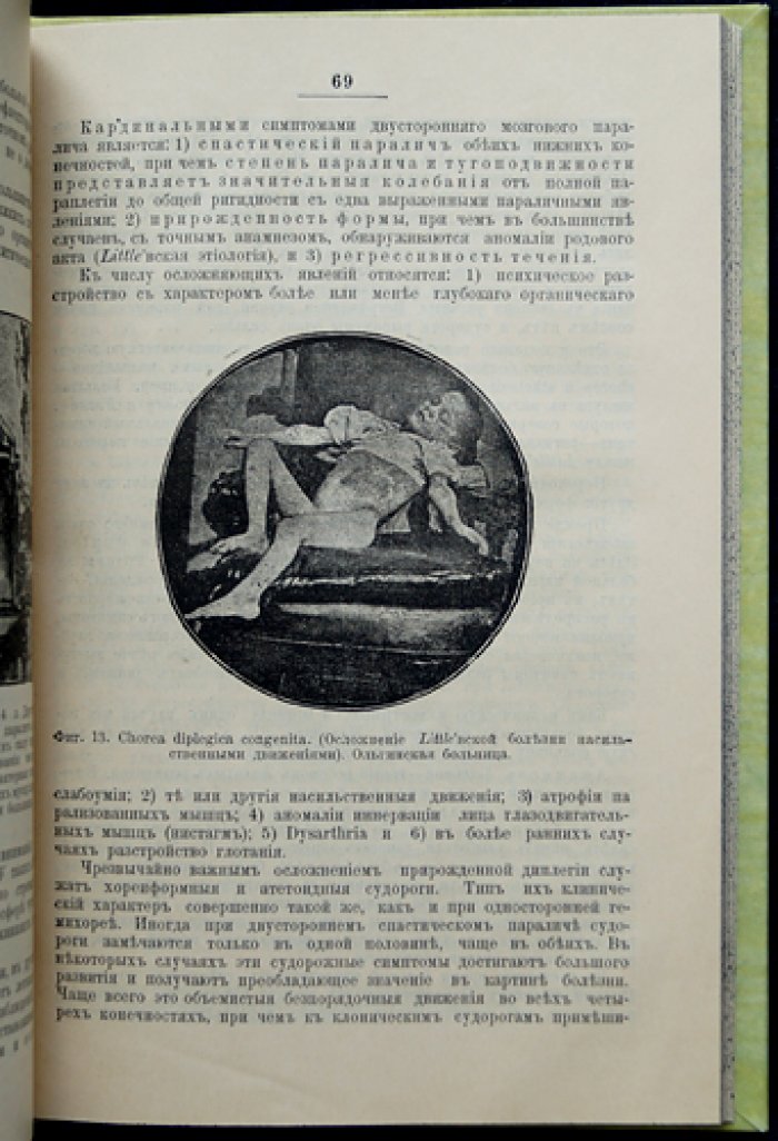 Клинические лекции по нервным болезням детского возраста (1898)