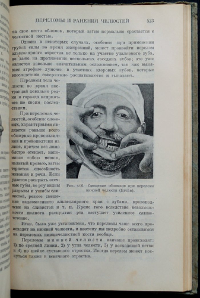 Гофунг Е.М. Клиника болезней зубов и полости рта: руководство по одонтологии и протезированию