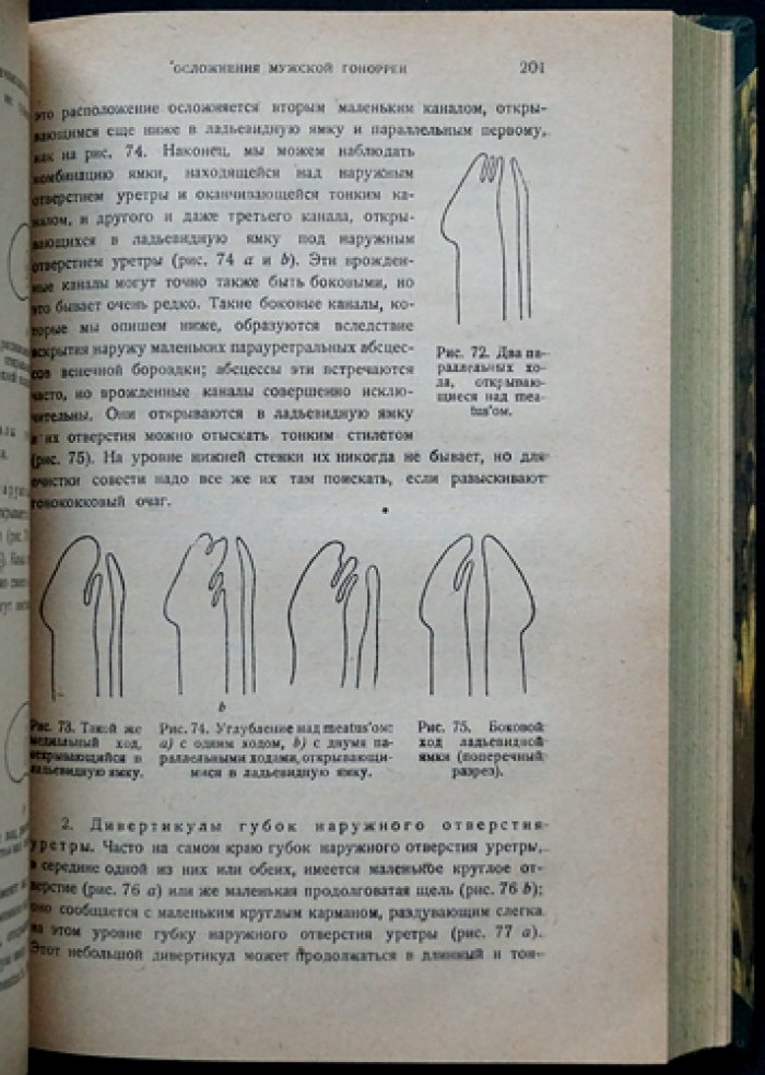 Жюль Жанэ. Диагностика и лечение гонореи у мужчин и женщин