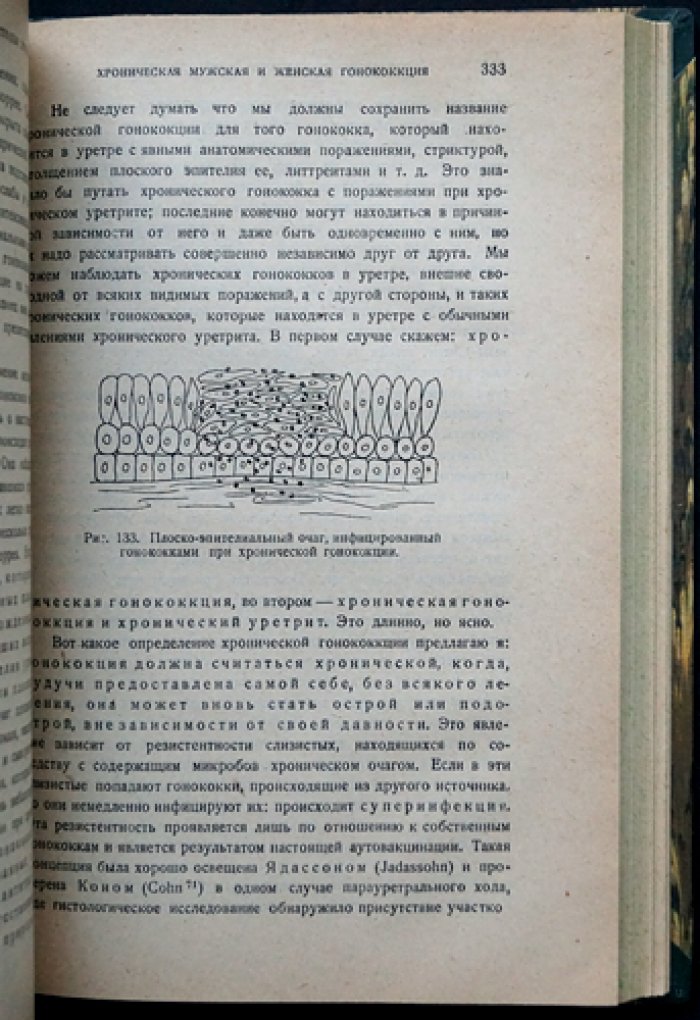 Жюль Жанэ. Диагностика и лечение гонореи у мужчин и женщин