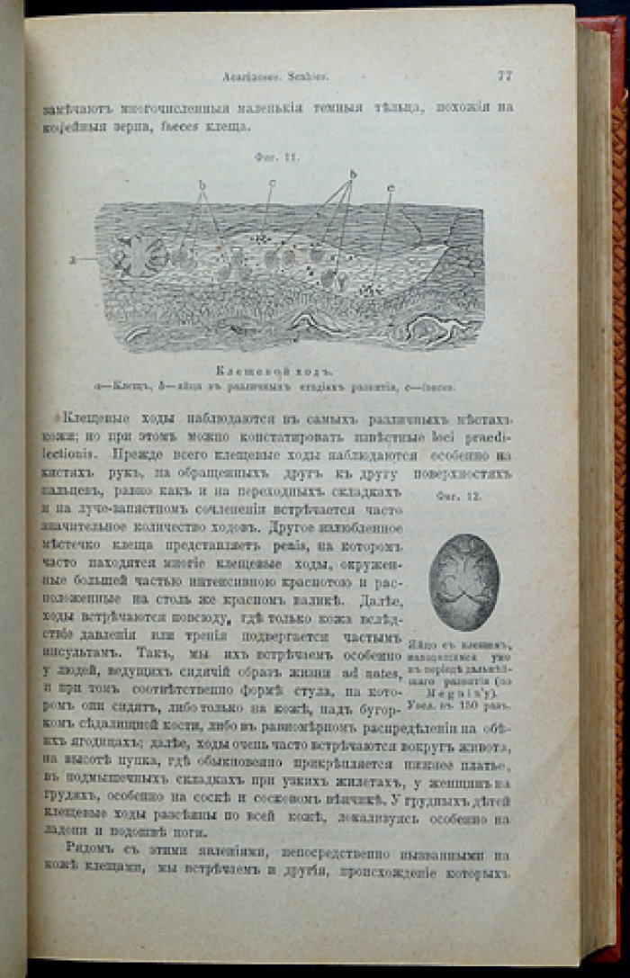 Гебра. Болезненные изменения кожи и её придатков. Клинические и системные взаимосвязи