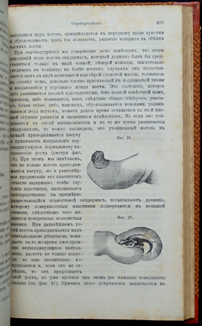 Гебра. Болезненные изменения кожи и её придатков. Клинические и системные взаимосвязи