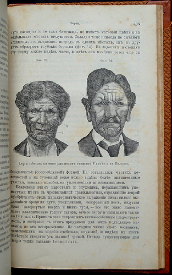 Гебра. Болезненные изменения кожи и её придатков. Клинические и системные взаимосвязи