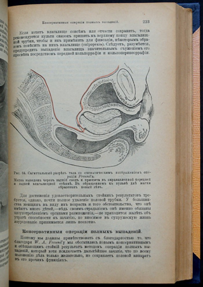 Оперативная гинекология. Руководство по хирургическому лечению в гинекологии (прижизненное издание)