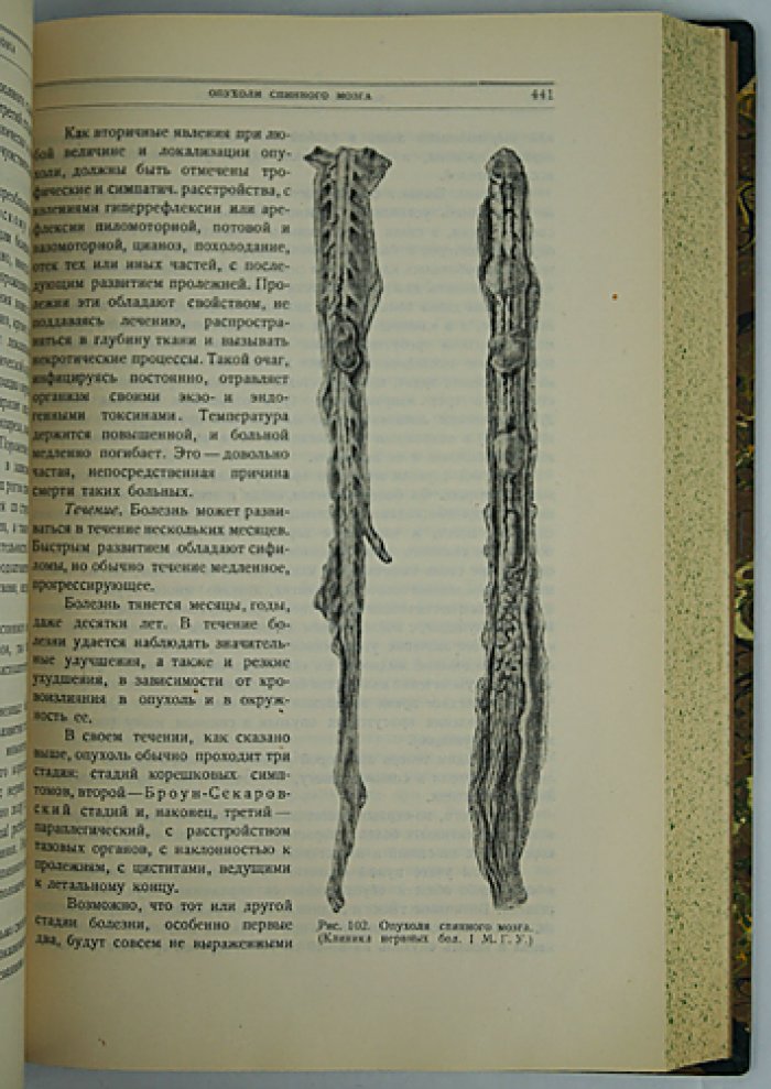 Курс нервных болезней (2-е изд., исправленное и дополненное)