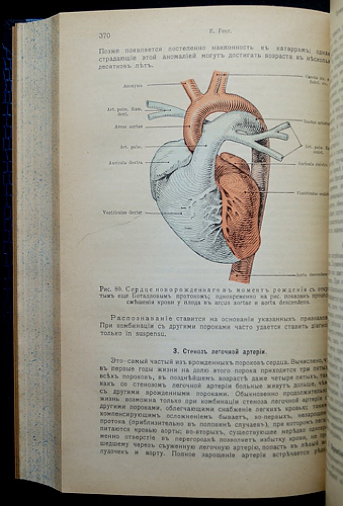 Руководство по детским болезням (классический учебник педиатрии с рисунками и таблицами)