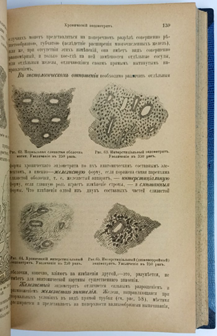 Шредер. Болезни женских половых органов: руководство по гинекологической патологии и терапии