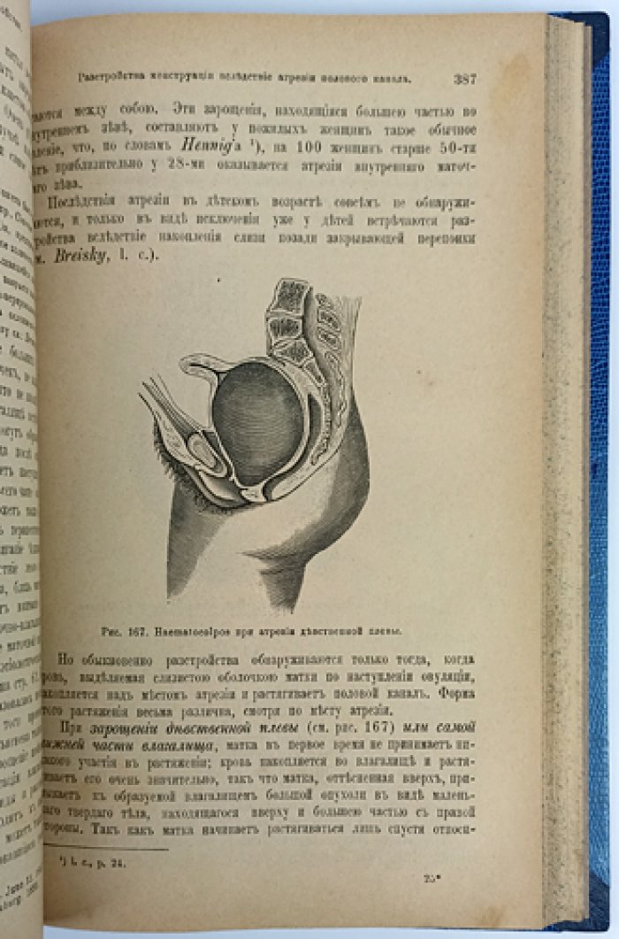 Шредер. Болезни женских половых органов: руководство по гинекологической патологии и терапии