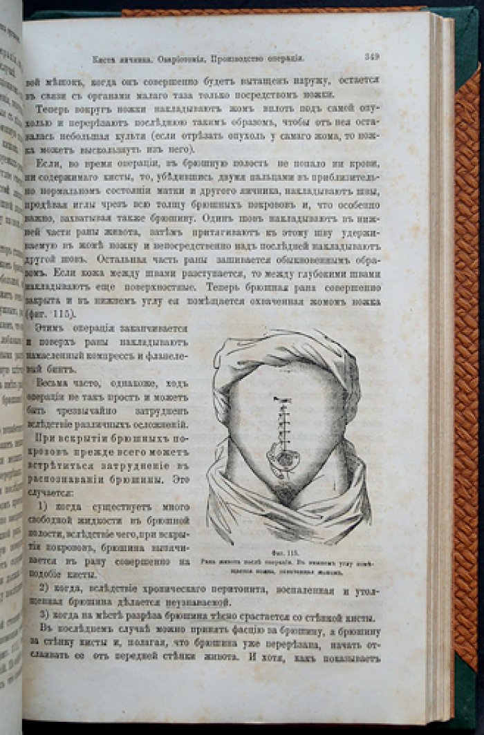 Шредер. Руководство к болезням женских половых органов: частная патология и терапия (с атласом рисунков)