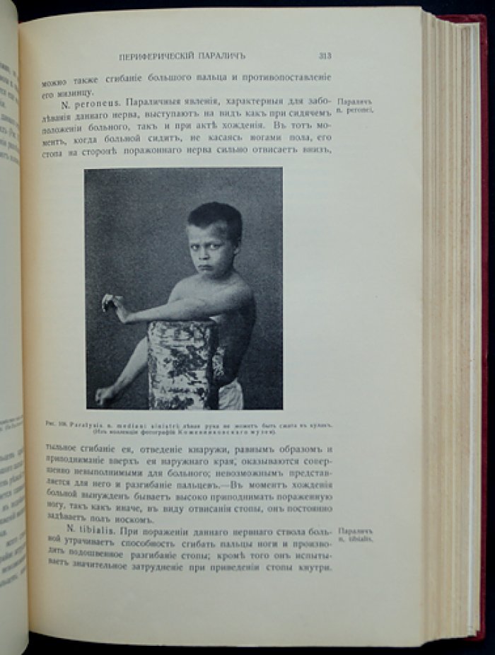 Даркшевич Л. Курс нервных болезней. Том 1 — переработанное издание (1912)