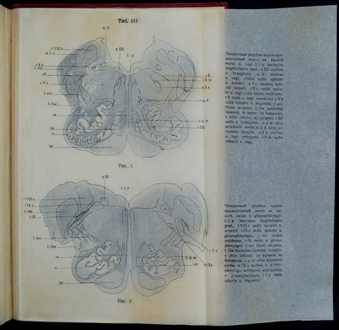 Даркшевич Л. Курс нервных болезней. Том 1 — переработанное издание (1912)