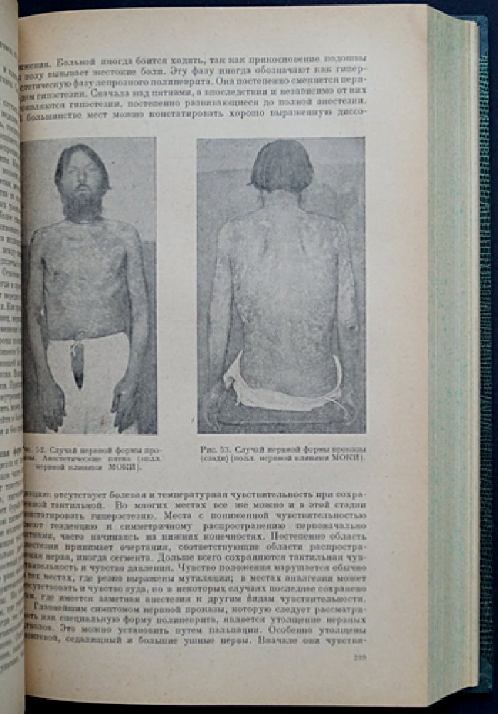 Учебник нервных болезней: в 2 томах. Том I — Общая часть; Том II — Специальная часть (2-е изд., исправленное и дополненное)