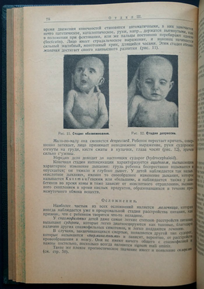 Детские болезни: руководство по болезням грудного возраста и практическому лечению (в двух частях, в одном переплёте)