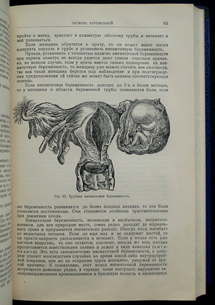 «Мать и дитя» — настольная книга для женщин (беременность, роды, уход и воспитание). 2-е издание, 1927