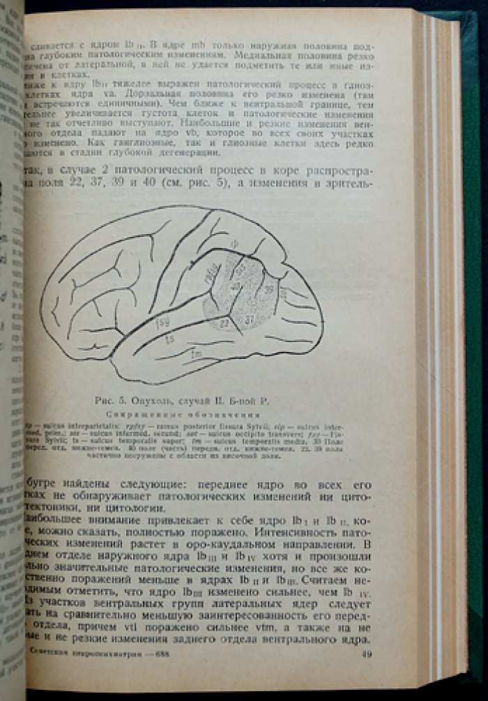 Советская невропсихиатрия. Сборник трудов (комплект из 2 томов в одном переплёте) — Ленинградские сборники