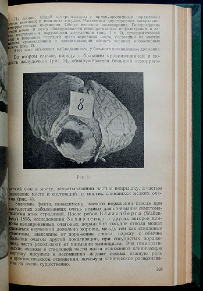 Советская невропсихиатрия. Сборник трудов (комплект из 2 томов в одном переплёте) — Ленинградские сборники